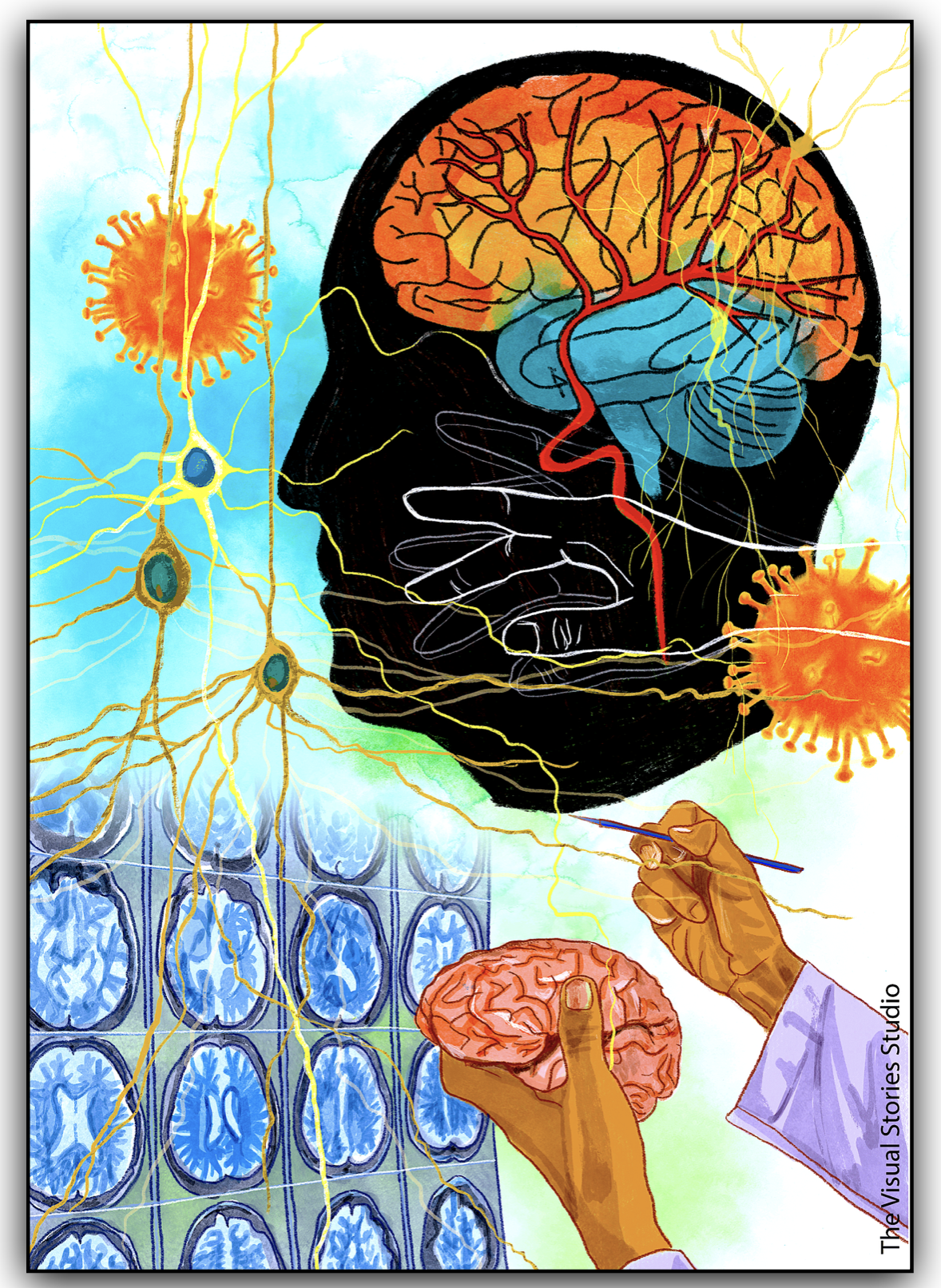 10th Annual UCLA Review of Clinical Neurology Banner